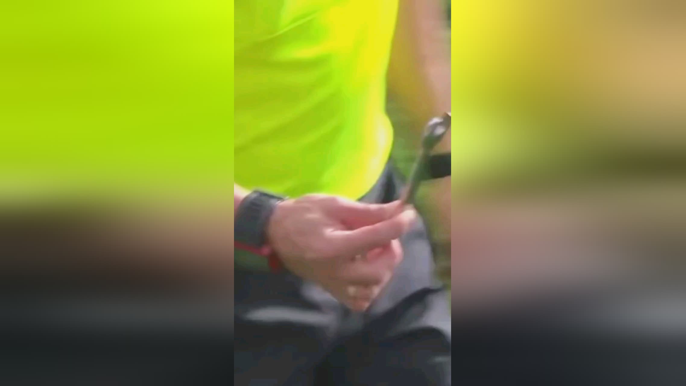 面对媒体